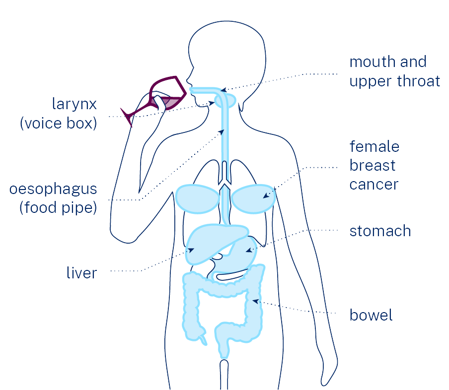 Diagram of the human body with labels for the mouth and upper throat, larynx (voice box), female breast cancer, oesophagus (food pipe), stomach, liver and bowel.